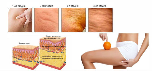 OUHOE Гель-скраб антицеллюитный для похудения - Sadoer фото 6