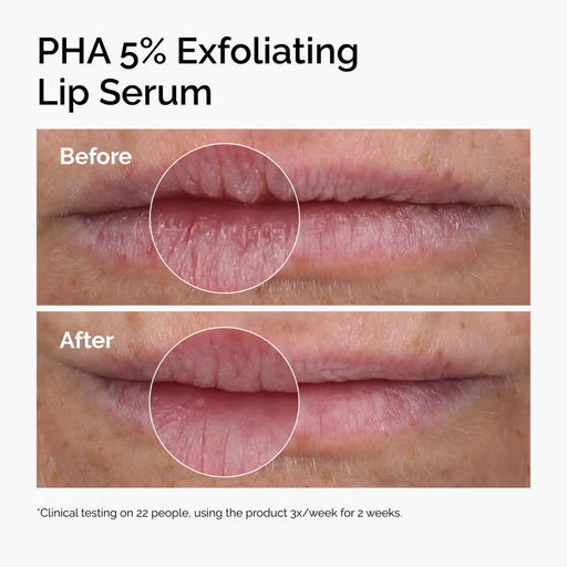Сыворотка-пилинг для губ PHA 5% Exfoliating Lip Serum