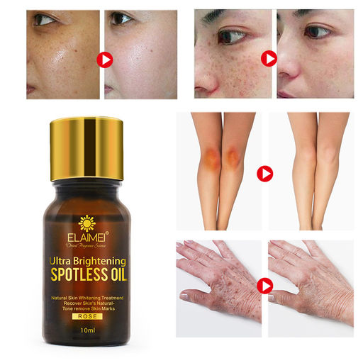 Эфирное масло от пигментации и шрамов с экстрактом розы Elaimel, 10 мл. - Elaimei фото 2