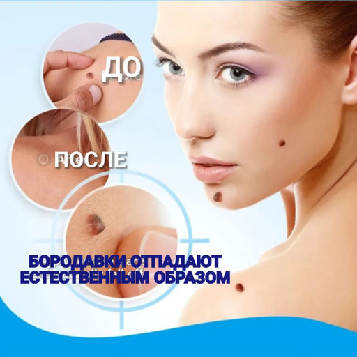 Крем для удаления бородавок, родинок и папиллом, 20 г - Aopen фото 2