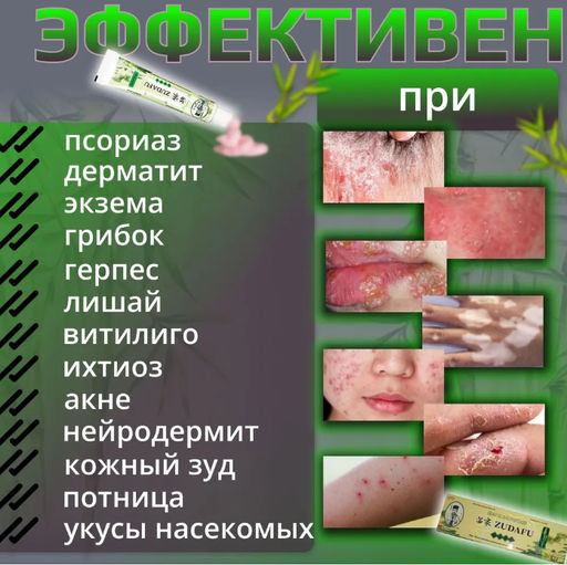 Зудафу Zudafu Семейный доктор Мазь Крем от псориаза, экземы и дерматита, 15 гр - Aopen фото 5